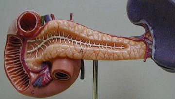 Pankreas Kanseri Ameliyatı Riskleri ve Sonrası Pankreas Kanseri Ameliyatı Riskleri ve Sonrası